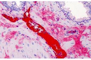 Anti-A2M / Alpha-2-Macroglobulin antibody IHC of human prostate.