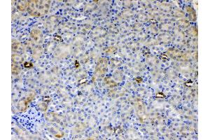 IHC analysis of ALDH1A3 using anti- ALDH1A3 antibody .