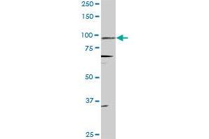 PGR monoclonal antibody (M08), clone 4E9. (Progesterone Receptor anticorps  (AA 1-110))
