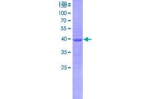 Image no. 1 for Sema Domain, Immunoglobulin Domain (Ig), Short Basic Domain, Secreted, (Semaphorin) 3B (SEMA3B) (AA 1-132) protein (GST tag) (ABIN1989816)
