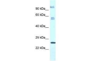 Western Blot showing TMEM222 antibody used at a concentration of 1. (TMEM222 anticorps  (C-Term))