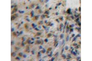 Used in DAB staining on fromalin fixed paraffin-embedded Ovary tissue