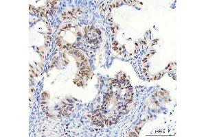 IHC analysis of DDX1 using anti-DDX1 antibody (ABIN7602052).