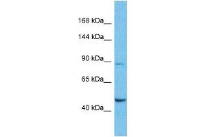 Host:  Rabbit  Target Name:  SUPT6H  Sample Type:  Lung Tumor lysates  Antibody Dilution:  1. (Spt6 anticorps  (N-Term))