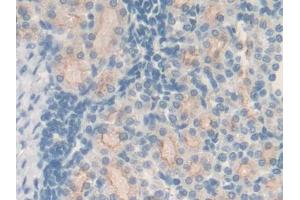 DAB staining on IHC-P; Samples: Rat Kidney Tissue