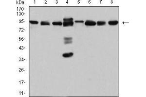 Western blot analysis using DDX1 mouse mAb against Hela (1), MCF-7 (2), A431 (3), PC-3 (4), NIH/3T3 (5), Jurkat (6), U251 (7), and HEK293 (8) cell lysate.