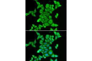 Immunofluorescence analysis of MCF7 cells using STRN3 antibody . (STRN3 anticorps  (AA 200-460))
