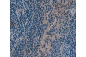 IHC-P analysis of Kidney tissue, with DAB staining. (HCK anticorps  (AA 2-524))