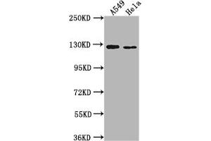 Western Blot Positive WB detected in: A549 whole cell lysate, Hela whole cell lysate All lanes: IGSF3 antibody at 1:2000 Secondary Goat polyclonal to rabbit IgG at 1/50000 dilution Predicted band size: 136, 138 kDa Observed band size: 125 kDa (IGSF3 anticorps  (AA 111-399))