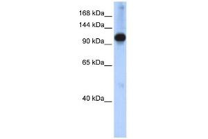 WB Suggested Anti-SMARCAL1 Antibody Titration:  0. (SMARCAL1 anticorps  (N-Term))