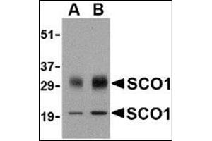 Western blot analysis of SCO1 in human brain tissue lysate with this product at (A) 0. (SCO1 anticorps  (Center))