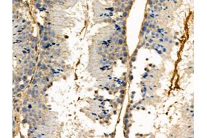 Phospho-PBK/TOPK (Ser32) Antibody at 1/100 staining Mouse testis tissue by IHC-P. (PBK anticorps  (pSer32))