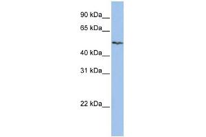 WB Suggested Anti-SLC16A6 Antibody Titration:  0. (SLC16A6 anticorps  (Middle Region))