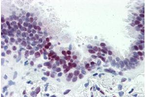 Human Lung (formalin-fixed, paraffin-embedded) stained with CASZ1 antibody ABIN364232 at 5 ug/ml followed by biotinylated goat anti-rabbit IgG secondary antibody ABIN481713, alkaline phosphatase-streptavidin and chromogen. (CASZ1 anticorps  (N-Term))
