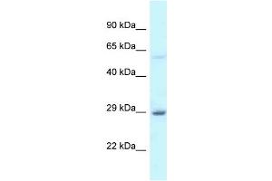 WB Suggested Anti-EIF6 Antibody Titration: 1. (EIF6 anticorps  (C-Term))