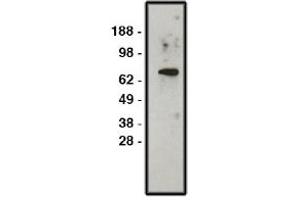 Image no. 1 for anti-Solute Carrier Family 9, Subfamily A (NHE1, Cation Proton Antiporter 1), Member 1 (SLC9A1) antibody (ABIN4620363) (SLC9A1 anticorps)