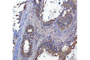 IHC analysis of SOCS5 using anti-SOCS5 antibody (ABIN7601562). (SOCS5 anticorps  (AA 386-536))