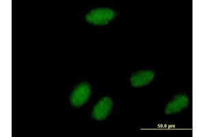 Immunofluorescence of  purified  MaxPab antibody to POLR3K on HeLa cell.