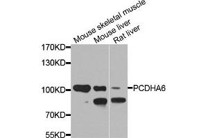 Western blot analysis of extracts of various cell lines, using PCDHA6 antibody. (PCDHA6 anticorps)
