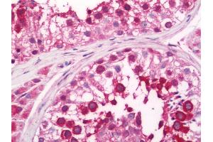 anti-Gse1 coiled-coil protein (GSE1) (AA 463-636) antibody