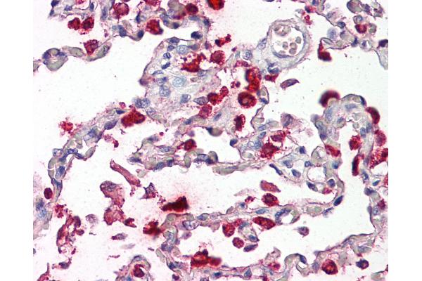 SFTPB anticorps  (AA 194-243)