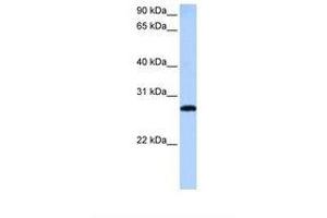 Image no. 1 for anti-MAX-Like Protein X (MLX) (AA 197-246) antibody (ABIN6738772) (MLX anticorps  (AA 197-246))