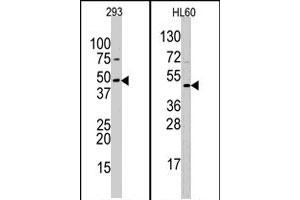 Western blot analysis of SUV39H2 polyclonal antibody  in 293 and HL-60 cell line lysates (35 ug/lane). (SUV39H2 anticorps  (AA 308-337))