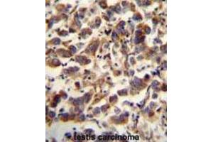 Immunohistochemistry (IHC) image for anti-Transcription Factor A, Mitochondrial (TFAM) antibody (ABIN5015230) (TFAM anticorps)