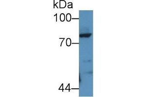 Detection of POSTN in Rat Lung lysate using Polyclonal Antibody to Periostin (POSTN)
