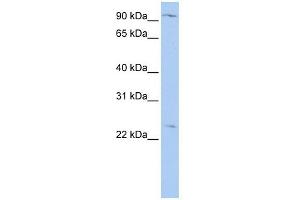 OSBPL8 antibody used at 1 ug/ml to detect target protein.
