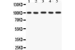 Anti- FGFR4 antibody, Western blotting All lanes: Anti FGFR4  at 0.
