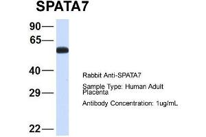 Host: Rabbit  Target Name: SPATA7  Sample Tissue: Human Adult Placenta  Antibody Dilution: 1.