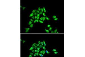 Immunofluorescence analysis of HeLa cells using DCTN1 Polyclonal Antibody (Dynactin 1 anticorps)