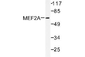 Image no. 1 for anti-Myocyte Enhancer Factor 2A (MEF2A) antibody (ABIN265517) (MEF2A anticorps)