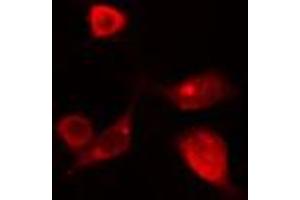 ABIN6274118 staining HT29 cells by IF/ICC. (T-Box 10 anticorps  (Internal Region))