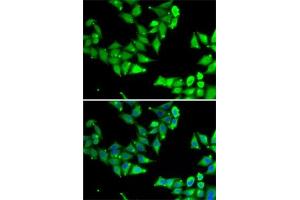 Immunofluorescence analysis of U2OS cells using OGFR Rabbit pAb (ABIN6128395, ABIN6145006, ABIN6145007 and ABIN6222871) at dilution of 1:50 (40x lens). (OGFR anticorps  (AA 1-280))