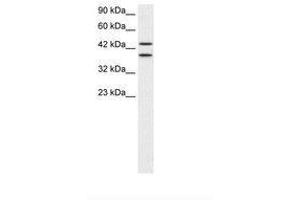 Image no. 1 for anti-Zinc Finger Protein 839 (ZNF839) (AA 530-579) antibody (ABIN202500) (ZNF839 anticorps  (AA 530-579))