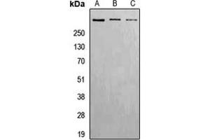 Western blot analysis of ATM (pS1981) expression in Hela (A), Raw264. (ATM anticorps  (pSer1981))