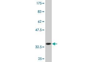 Western Blot detection against Immunogen (34.
