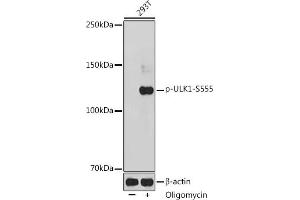 Western blot analysis of extracts of 293T cells, using Phospho-ULK1-S555 antibody (ABIN6135333, ABIN6136282, ABIN6136283 and ABIN6225654) at 1:1000 dilution. (ULK1 anticorps  (pSer555))
