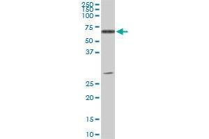 ATP6AP1 monoclonal antibody (M01), clone 3A2.