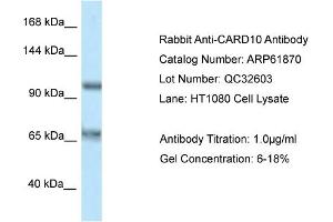Western Blotting (WB) image for anti-Caspase Recruitment Domain Family, Member 10 (CARD10) (C-Term) antibody (ABIN970291) (CARD10 anticorps  (C-Term))