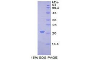 SDS-PAGE analysis of Human COL8A1 Protein. (COL8A1 Protéine)