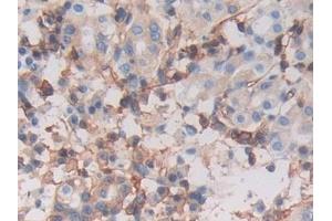 Detection of MHCC in Human Stomach Tissue using Polyclonal Antibody to Major Histocompatibility Complex Class I C (MHCC) (MHCC (AA 48-305) anticorps)