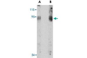 Western blot analysis of BICD2 in A-549 cell lysate with BICD2 polyclonal antibody  at (A) 1 and (B) 2 ug/mL . (BICD2 anticorps  (C-Term))
