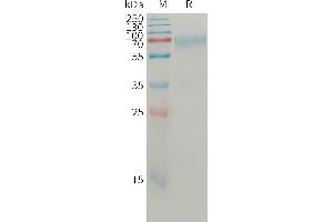 Human AN(19-496) Protein, His Tag on SDS-PAGE under reducing condition.