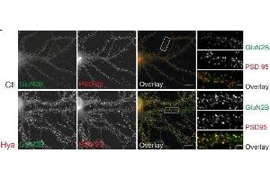 Expression of GluN2B in rat hippocampal neuronsImmunocytochemistry of living rat dissociated hippocampal neurons.