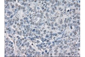 Immunohistochemical staining of paraffin-embedded Kidney tissue using anti-PPP5Cmouse monoclonal antibody. (PP5 anticorps)