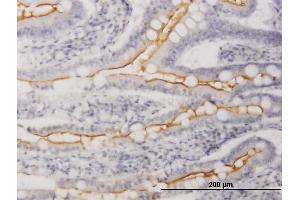Immunoperoxidase of purified MaxPab antibody to WISP1 on formalin-fixed paraffin-embedded human small Intestine.
