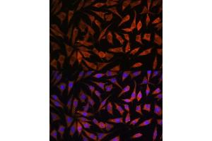 Immunofluorescence analysis of L929 cells using RPS8 antibody (ABIN7270041) at dilution of 1:100.